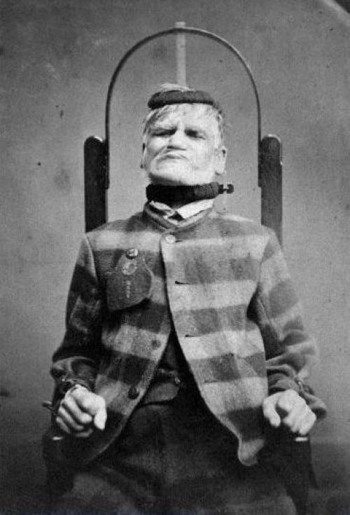 Man in a restraint chair in a Wakefield, Yorkshire mental asylum circa 1869