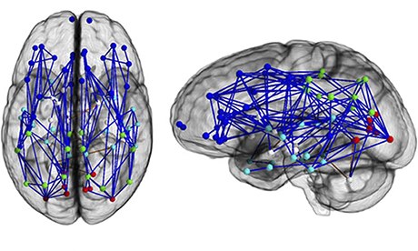 Neural traffic in the typical male brain
